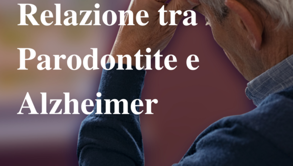 Relazione tra Parodontite e Alzheimer: cosa bisogna sapere